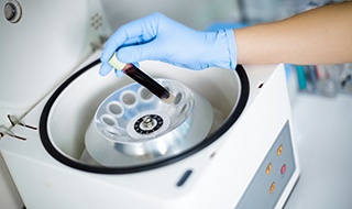 Gloved hand placing vial of blood in centrifuge