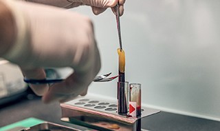 Gloved hands preparing platelet-rich fibrin application