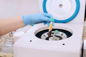 Medical professional removing processed blood from centrifuge 